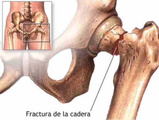 Remodelado Óseo